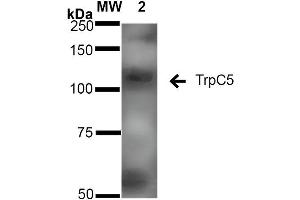 Western Blot analysis of Rat Brain Membrane showing detection of ~110 kDa TrpC5 protein using Mouse Anti-TrpC5 Monoclonal Antibody, Clone S67-15 .