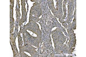 IHC analysis of PARK7/DJ1 using anti-PARK7/DJ1 antibody (ABIN7600468). (PARK7/DJ1 antibody  (AA 2-189))