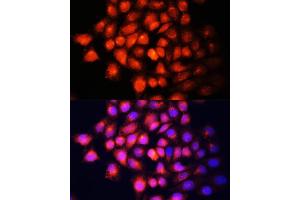 Immunofluorescence analysis of HeLa cells using IGF2 Polyclonal Antibody (ABIN6130483, ABIN6142237, ABIN6142238 and ABIN6218206) at dilution of 1:100 (40x lens). (IGF2 antibody  (AA 25-180))