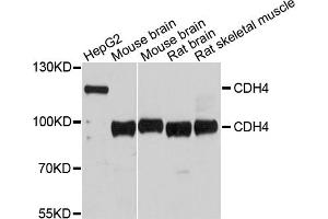 Western blot analysis of extracts of various cell lines, using CDH4 antibody. (Cadherin 4 antibody)