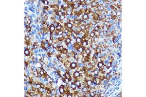 Immunohistochemistry (IHC) image for anti-WW and C2 Domain Containing 1 (WWC1) (AA 950-1050) antibody (ABIN7271388)