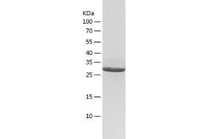 Western Blotting (WB) image for Geranylgeranyl Diphosphate Synthase 1 (GGPS1) (AA 1-300) protein (His tag) (ABIN7284755) (GGPS1 Protein (AA 1-300) (His tag))