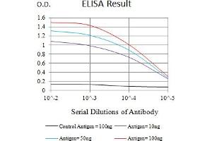 Black line: Control Antigen (100 ng),Purple line: Antigen (10 ng), Blue line: Antigen (50 ng), Red line:Antigen (100 ng) (IL13 Receptor alpha 1 antibody  (AA 22-343))