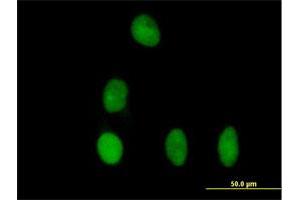 Immunofluorescence of purified MaxPab antibody to DBR1 on HeLa cell. (DBR1 antibody  (AA 1-544))