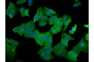 Immunofluorescence staining of HepG2 cells with ABIN7161592 at 1:100, counter-stained with DAPI. (QPRT antibody  (AA 113-254))