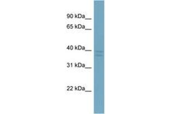 CXorf66 antibody  (AA 107-156)