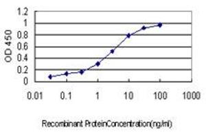 Detection limit for recombinant GST tagged CETN1 is approximately 0. (Centrin 1 antibody  (AA 1-100))