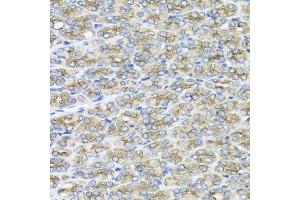 Immunohistochemistry of paraffin-embedded mouse stomach using STXBP2 antibody at dilution of 1:100 (x40 lens). (STXBP2 antibody)