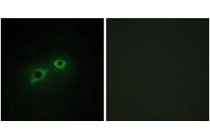 Immunofluorescence analysis of HepG2 cells, using ENTK Antibody. (TMPRSS15 antibody  (AA 81-130))
