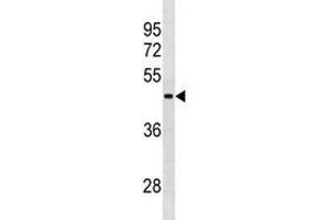 RBMY1A1 antibody western blot analysis in NCI-H292 lysate. (RBMY1A1 antibody  (AA 468-496))
