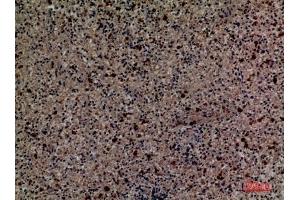 Immunohistochemical analysis of paraffin-embedded human-spleen, antibody was diluted at 1:100. (CD58 antibody  (Internal Region))