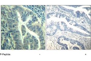 Image no. 3 for anti-Cyclin-Dependent Kinase 6 (CDK6) (pTyr24) antibody (ABIN319290) (CDK6 antibody  (pTyr24))
