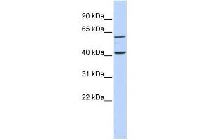 TCTN3 antibody used at 1 ug/ml to detect target protein.