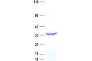 Validation with Western Blot (RHNO1 Protein (His tag))
