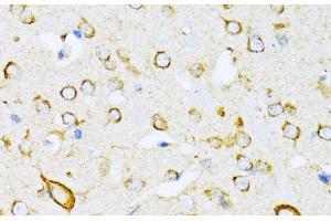 Immunohistochemistry of paraffin-embedded Mouse brain using VARS Polyclonal Antibody at dilution of 1:100 (40x lens). (VARS antibody)