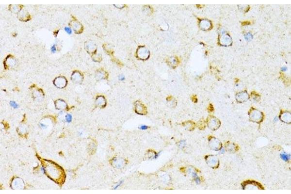 VARS antibody