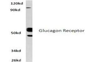 Image no. 1 for anti-Glucagon Receptor (GCGR) antibody (ABIN317704) (Glucagon Receptor antibody)