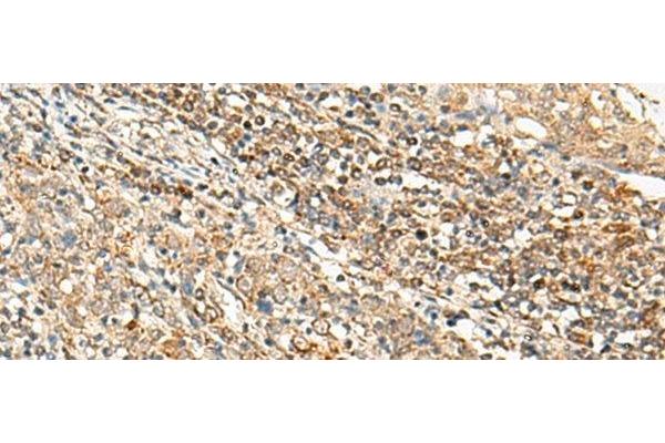 SNAPC5 antibody