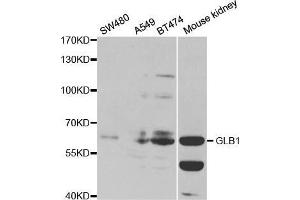 Western blot analysis of extracts of various cell lines, using GLB1 antibody. (GLB1 antibody  (AA 1-270))