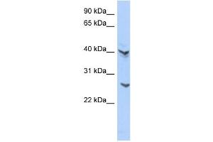 ATP6V0E2 antibody used at 1 ug/ml to detect target protein. (ATP6V0E2 antibody  (Middle Region))
