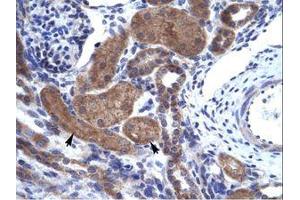 Image no. 1 for anti-IKAROS Family Zinc Finger 2 (IKZF2) (AA 396-445) antibody (ABIN203095) (IKZF2 antibody  (AA 396-445))