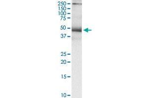 Immunoprecipitation of TNFRSF10B transfected lysate using anti-TNFRSF10B MaxPab rabbit polyclonal antibody and Protein A Magnetic Bead , and immunoblotted with TNFRSF10B purified MaxPab mouse polyclonal antibody (B01P) . (TNFRSF10B antibody  (AA 1-440))