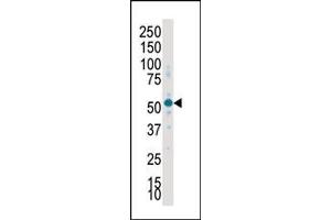 Western blot analysis of anti-SKG2 Pab (ABIN392461 and ABIN2842049) in placenta lysate. (SGK2 antibody  (C-Term))