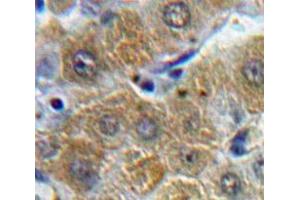 #VALUE! (ORM1 antibody  (AA 19-201))