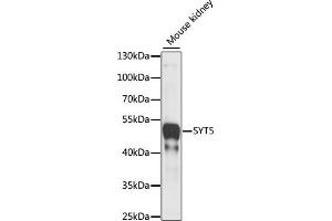 Western blot analysis of extracts of Mouse kidney, using SYT5 antibody (ABIN7270676) at 1:1000 dilution. (Synaptotagmin V antibody  (AA 1-110))