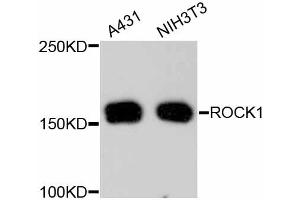 Western blot analysis of extracts of various cell lines, using ROCK1 antibody (ABIN4905028).
