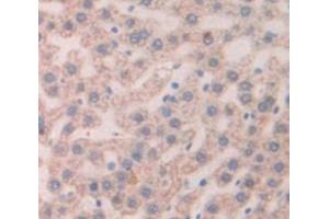 Figure. (Thymic Stromal Lymphopoietin antibody  (AA 75-196))
