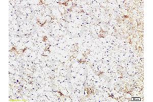 Formalin-fixed and paraffin embedded rat heart tissue labeled Anti-CTGF Polyclonal Antibody, Unconjugated (ABIN672636) at 1:200, followed by conjugation to the secondary antibody and DAB staining (CTGF antibody  (AA 221-349))