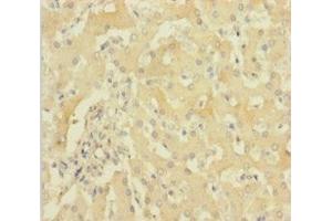 Immunohistochemistry of paraffin-embedded human liver tissue using ABIN7154984 at dilution of 1:100 (HBG1 antibody  (AA 2-147))