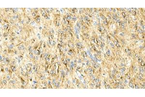 IHC analysis of GFAP using anti-GFAP antibody (ABIN7602675). (GFAP antibody  (AA 93-432))