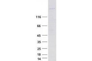 Validation with Western Blot (Myopalladin Protein (MYPN) (Myc-DYKDDDDK Tag))