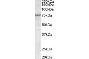 Western Blotting (WB) image for anti-Transformation Related Protein 63 (TRP63) (N-Term), (Trp63) antibody (ABIN2465086) (TRP63 antibody  (N-Term, Trp63))