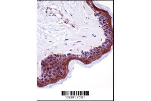 LSM14A Antibody immunohistochemistry analysis in formalin fixed and paraffin embedded human skin tissue followed by peroxidase conjugation of the secondary antibody and DAB staining. (LSM14A antibody  (C-Term))