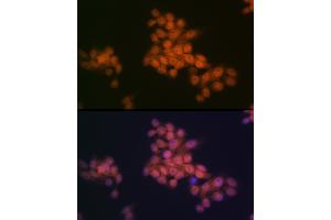 Immunofluorescence analysis of HeLa cells using WAPL Rabbit mAb (ABIN7271380) at dilution of 1:100 (40x lens). (WAPAL antibody)