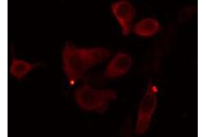 ABIN6274390 staining Hela cells by IF/ICC. (AGPAT9 antibody  (Internal Region))