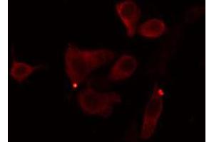 ABIN6274390 staining Hela cells by IF/ICC. (AGPAT9 antibody  (Internal Region))