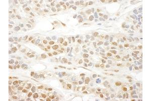 anti-Megakaryoblastic Leukemia (Translocation) 1 (MKL1) (AA 700-750) antibody