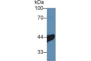 Detection of IL3Ra in Human A549 cell lysate using Polyclonal Antibody to Interleukin 3 Receptor Alpha (IL3Ra) (IL3RA antibody  (AA 167-331))