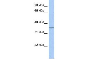 Western Blotting (WB) image for anti-Glycosyltransferase 6 Domain Containing 1 (GLT6D1) antibody (ABIN2459266) (GLT6D1 antibody)