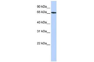 SDCCAG8 antibody used at 1 ug/ml to detect target protein.