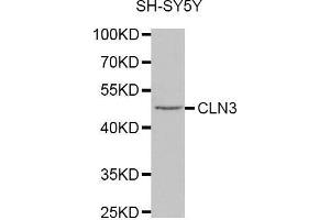 Western blot analysis of extracts of SH-SY5Y cell line, using CLN3 antibody. (CLN3 antibody  (AA 1-280))