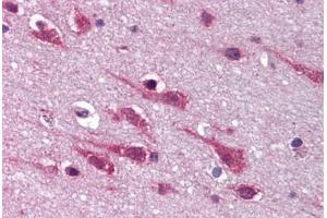 Human Brain, Cortex (formalin-fixed, paraffin-embedded) stained with MAPK9 antibody ABIN292321 at 20 ug/ml followed by biotinylated goat anti-rabbit IgG secondary antibody ABIN481713, alkaline phosphatase-streptavidin and chromogen. (JNK2 antibody  (C-Term))