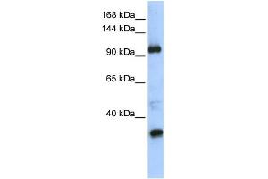 WB Suggested Anti-TUT1 Antibody Titration:  0. (TUT1 antibody  (Middle Region))