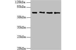 Western blot All lanes: ENC1 antibody at 5 μg/mL Lane 1: MCF-7 whole cell lysate Lane 2: HepG2 whole cell lysate Lane 3: Mouse brain tissue Lane 4: A549 whole cell lysate Secondary Goat polyclonal to rabbit IgG at 1/10000 dilution Predicted band size: 67, 58 kDa Observed band size: 67 kDa (ENC1 antibody  (AA 1-230))
