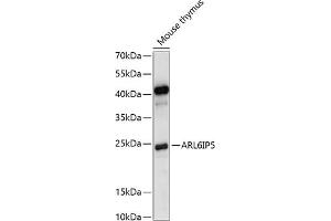 Western blot analysis of extracts of mouse thymus, using IP5 antibody (ABIN7265499) at 1:1000 dilution. (ARL6IP5 antibody  (C-Term))
