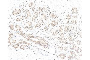 Immunohistochemistry (IHC) image for anti-BRCA1 Associated Protein-1 (Ubiquitin Carboxy-terminal Hydrolase) (BAP1) (AA 475-525) antibody (ABIN7795816)
